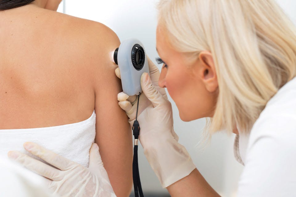skin cancer screenings